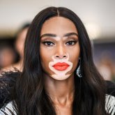 Winnie Harlow