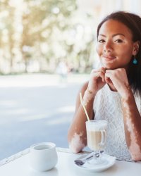 Le vitiligo : quand l'épiderme est envahi de tâches blanches