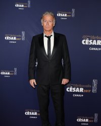 Franck Dubosc raconte son opération intime et déclenche un fou rire général