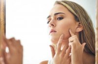 10 trucs (insoupçonnés) pour soigner efficacement son acné