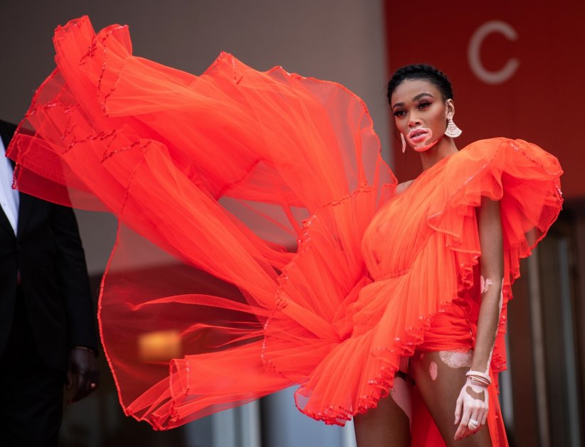 Winnie Harlow n'a pas froid aux yeux Winnie Harlow n'a pas froid aux yeux