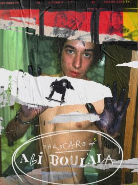 The Scars of Ali Boulala
