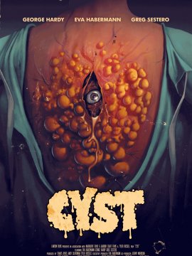Cyst
