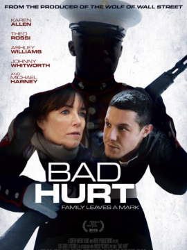 Bad Hurt