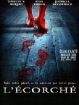 L'Ecorché