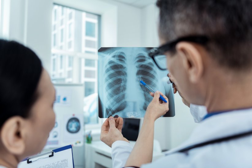 L'œdème pulmonaire L'œdème pulmonaire