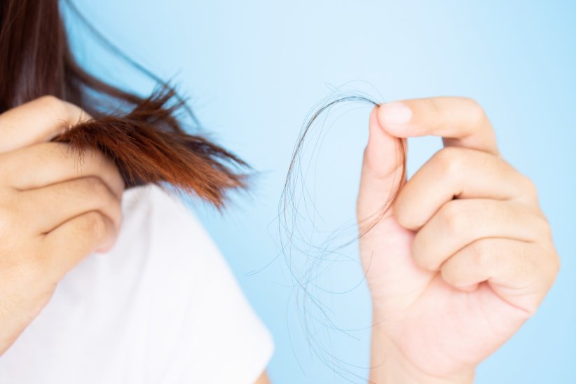 Une perte de cheveux Une perte de cheveux