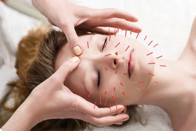 Les maux soulagés par l'acupuncture Les maux soulagés par l'acupuncture