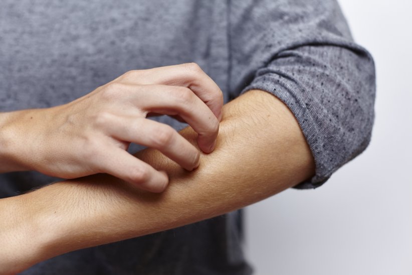 Un allié contre le psoriasis Un allié contre le psoriasis