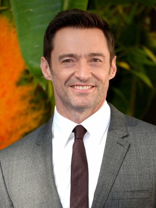 Hugh Jackman : il s'est fait opérer cinq fois ! Hugh Jackman : il s'est fait opérer cinq fois !