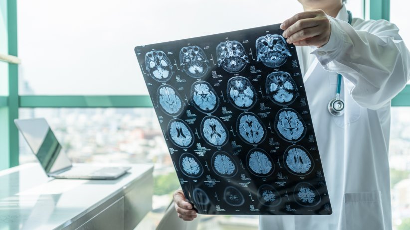 Un traumatisme crânien léger Un traumatisme crânien léger