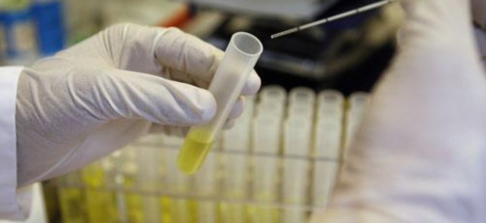 Medesis Pharma : de bonnes nouvelles pour NanosiRNA HD dans la maladie de Huntington