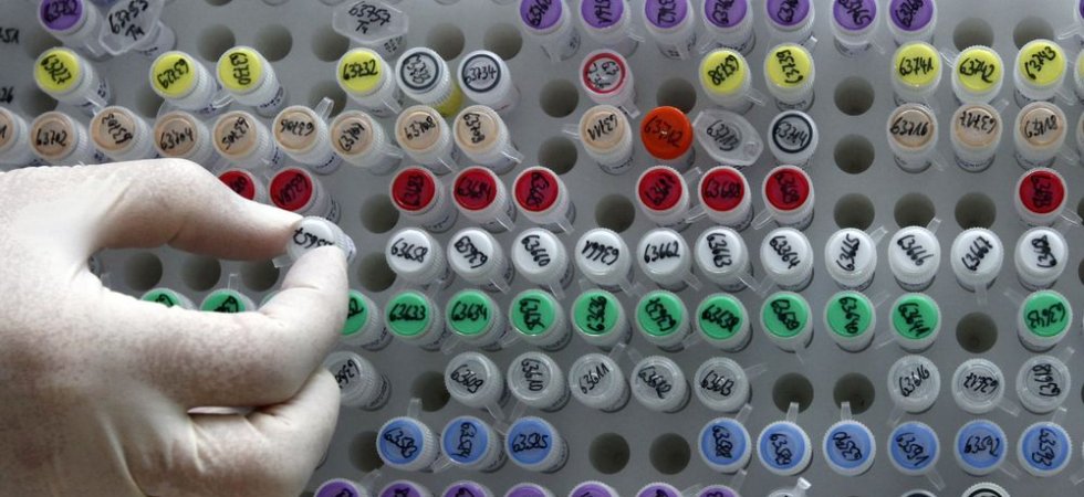 Biocartis lance le test Idylla GeneFusion