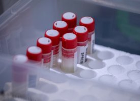 Covid-19 : les premiers tests salivaires sont déployés