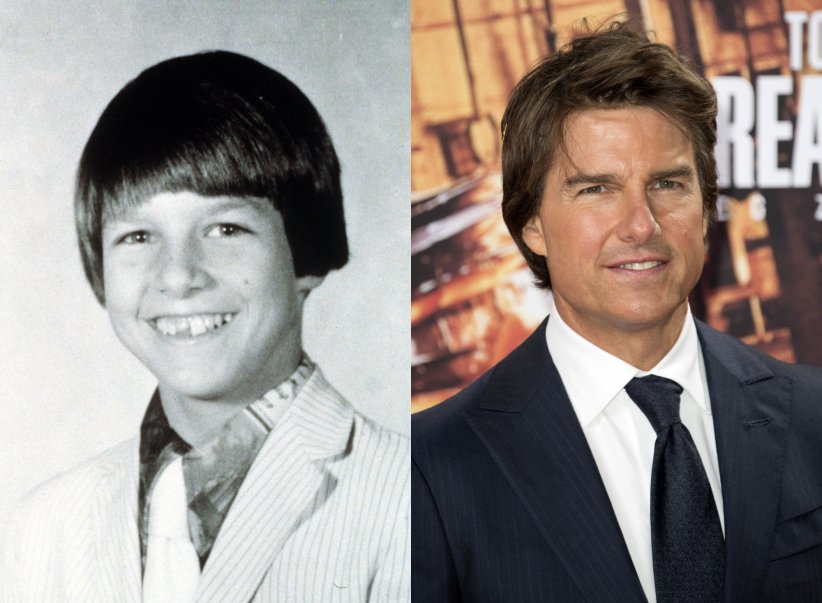 Tom Cruise : il est lui aussi passé par la case "dentiste"