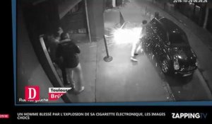 Un homme brûlé par l'explosion de sa cigarette électronique, les images chocs