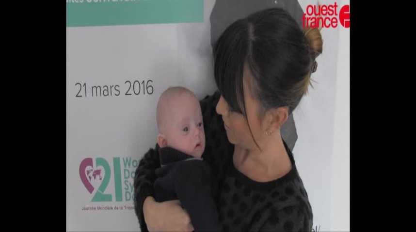 Marcel 4 Mois Trisomique Est Le Plus Beau Bebe Du Monde Soutenez Le En Portant Des Chaussettes Depareillees Sur Orange Videos