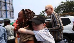 RDC: les albinos en quête de reconnaissance