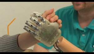 Une main artificielle redonne à un amputé le sens du toucher