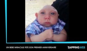 Malgré les pronostics des médecins, un bébé atteint d'une rare malformation fête son premier anniversaire
