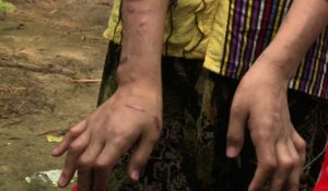 Birmanie: l'enfer des enfants esclaves, battues et brûlées