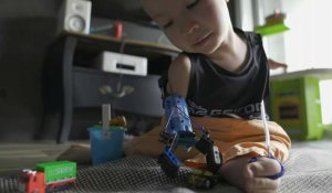 À seulement 9 ans, il crée sa propre prothèse…en Lego 