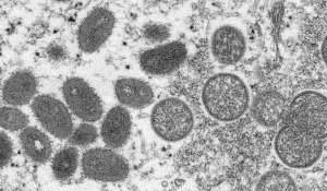 L'Europe reste l'épicentre de la flambée de la variole du singe, selon l'OMS