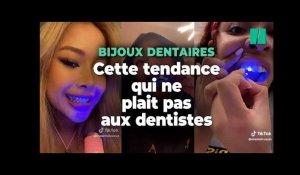 VIDÉO. «Il aura un dentier à 30 ans» : la tendance des dents limées  inquiète les dentistes - Le Parisien