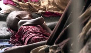 Somalie: les enfants, premières victimes de la sécheresse (CICR)