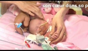 Royaume-Uni : un bébé naît avec le cœur en dehors de sa poitrine et réussit à survivre (vidéo)
