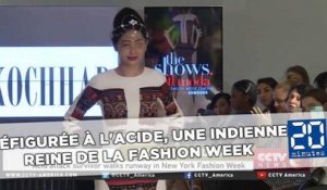 Défigurée à l'acide, une jeune Indienne reine de la Fashion Week