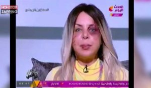 Battue par son mari, une présentatrice égyptienne anime son émission le visage "tuméfié" (Vidéo)