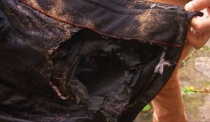 Brûlé par un vestige de la guerre sur les plages du D-Day