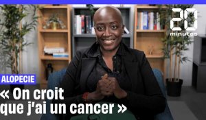 « On croit que j'ai un cancer », témoigne Reshada qui souffre d'alopécie