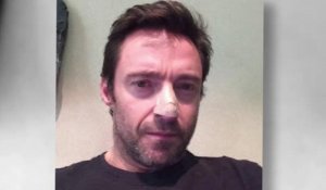 Hugh Jackman se fait enlever des cellules cancéreuses