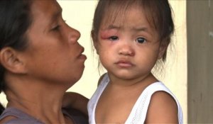 Philippines : les séquelles psychologiques du typhon Haiyan