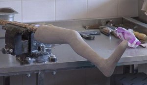 Ukraine: les amputés sans financement pour leurs prothèses