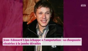 Jean-Edouard Lipa échappe à l'amputation : sa cicatrice choquante à la jambe dévoilée