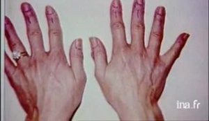 Info? Intox? Implants de faux ongles à vie?