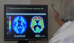 Le gouvernement annonce son plan sur Alzheimer