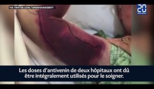 Un selfie avec un serpent lui coûte 140.000 euros de soin