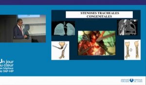 La chirurgie des malformation complexes de la trachée de l'enfant, Pr Noël Garabedian et Olivier Raisky
