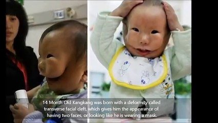 Ce Bebe Est Atteint D Une Malformation Tres Etrange Sur Orange Videos