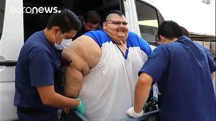 Mexique Juan Pedro Franco Salas L Homme Le Plus Gros Du Monde Opere Pour Un Pontage Gastrique