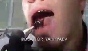 Ce Fou S Arrache Une Dent Tout Seul Avec Une Pince Sur Orange Videos