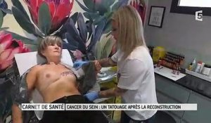 Cancer du sein : Après la reconstruction, une femme veut se faire tatouer... un mamelon ! Regardez