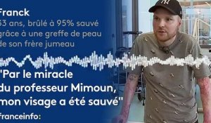 Franck :"Par le miracle du professeur Mimoun, mon visage a été sauvé"