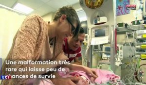 Royaume-Uni : un bébé naît avec le cœur en dehors de sa poitrine et réussit à survivre (vidéo)