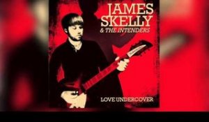 James Skelly - I'm A Man