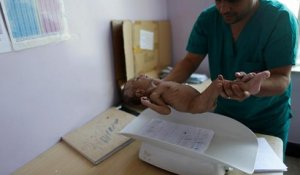 Yémen : cinq millions d'enfants menacés de famine